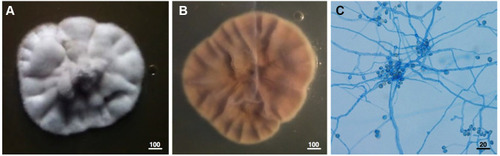 Figure 1 Culture of S. apiospermum CBS 117410 on Sabouraud Dextrose Agar (SDA), (A) front view, (B) reverse view, and (C) macroconidia of S. apiospermum stained by lactophenol cotton blue. Scale bar of A, B = 100 μm and C = 20 μm.