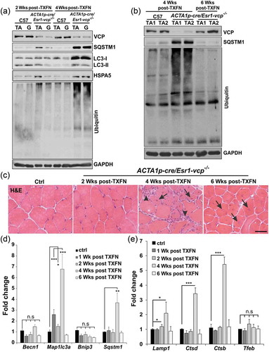 Figure 3. VCP is necessary for differentiated skeletal muscle survival. (a) Immunoblot of lysates from tibialis anterior (TA) or gastrocnemius (G) muscle of age-matched control (C57) or ACTA1p-cre/Esr1-vcp-/- mice after 2 and 4 wk post tamoxifen (TXFN) injection for 5 d using antibodies to VCP, SQSTM1, LC3, HSPA5, ubiquitin or GAPDH. (b) Immunoblot of lysates from TA of 2 age-matched control or 2 ACTA1p-cre/Esr1-vcp-/- mice after 4 and 6 wk post tamoxifen injection for 5 d using antibodies to VCP, SQSTM1, ubiquitin or GAPDH. (c) H & E of TA muscle from age-matched control or ACTA1p-cre/Esr1-vcp-/- mice after 2, 4 and 6 wk post tamoxifen injection for 5 d. Arrows point to regenerating fibers and arrowheads point to necrotic fibers. (d) Graph of fold expression change of mRNA of autophagic proteins from the TA muscle from control or ACTA1p-cre/Esr1-vcp-/- mice after 1, 2, 4 and 6 wk post tamoxifen injection for 5 d. (e) Graph of fold expression change of mRNA of lysosomal proteins from the TA muscle from control or ACTA1p-cre/Esr1-vcp-/- mice after 1, 2, 4 and 6 wk post tamoxifen injection for 5 d. *p < 0.05; **p < 0.01; ***p < 0.001; Scale: 100 μm.