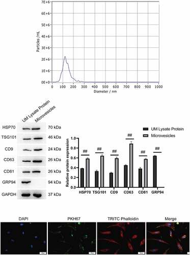 Figure 3. Identification of hUMSC-EVs. A, Detection of exosome particle diameters by NTA. B, Western blot was used to detect exosome markers HSP70, TSG101, CD9, CD63 and CD81. C, PKH67 labeled exosomes were co-cultured with ABMSCs for 12 h, and the green fluorescent-labeled exosomes entering the ABMSCs skeleton range labeled by red fluorescence were observed under a confocal microscope. Scale bar is 50 µm.