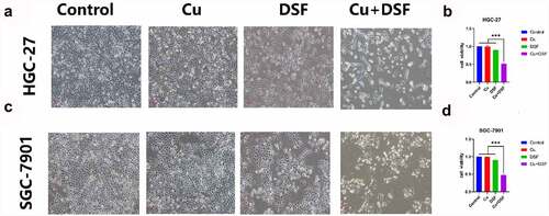 Figure 1. DSF/Cu inhibits the viability of GC cells. HGC-27 and SGC-7901 were exposed to Cu (0.2 μM), DSF (0.24 μM or 0.3 μM), or DSF + Cu (0.24 μM, 0.3 μM +0.2 μM) for 24 h. (a) The morphologic changes (X100 magnification) of HGC-27 after 24 h of drug exposure. (c) Cell viability of HGC-27 was analyzed across groups. (b) The morphologic changes (X100 magnification) of SGC-7901 after 24 h of drug exposure. (d) Cell viability of SGC-7901 was analyzed across groups at selected concentrations. Scale bar: 100 µm. Data are expressed as mean ± standard deviation of three independent experiments. * p < 0.05 vs. the DSF/Cu group.