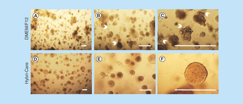 Figure 2.  Hybri-Care culture medium promotes the formation of more defined acini-like structure than Dulbecco's modified Eagle medium/F12 culture medium.Optical microscopy images of MCF-12A cell embedded in Matrigel after 14 days of culture. When using Dulbecco's modified Eagle medium/F12 medium to maintain cultures, resulting multicellular structures seem smaller, less defined and looser (A–C, arrowheads) than cells maintained in Hybri-Care medium (D–F). In Hybri-Care medium, acini are bigger, rounder, more defined and more compact. Scalebars: 250 μm.