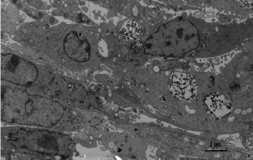 Figure 7 Transmission electron micrographs of Fe3O4 nanoparticle uptake by osteoblasts.