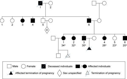 Figure 1 The pedigree of hereditary multiple exostoses in an Iranian family, including three affected sisters and two affected brothers, represents a typical autosomal dominant pattern.
