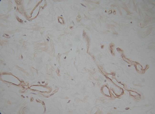 Figure 5. Peritoneal vessels immunohistochemical staining (×400).