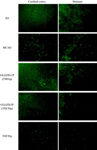 Figure 2. Fluorescence micrographs of [Ca2+]i in cerebral cortex and striatum neurone of MCAO rats (100×).