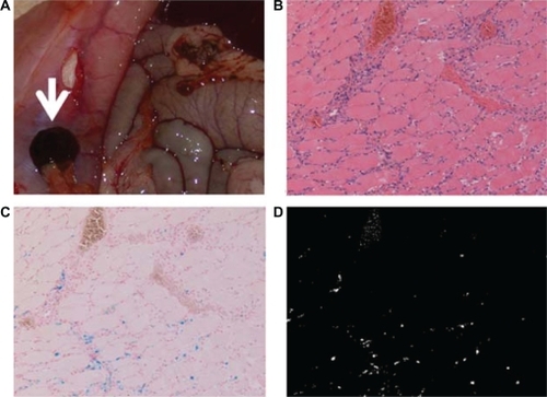Figure 5 Accumulation of DM-Cis in group 1 rats. a) Macroscopic image of DM-Cis accumulation in the peritoneum. b) H & E stains (X100) of rectus abdominis muscle tissue just under the pocket harboring the magnets. Note the aggregation of phagocytes in muscle tissue. c) Berlin-blue stains (X100). Iron distributed in the muscle tissues is blue. d) Masked image using Image-Pro Plus. Only portions dyed blue are identified by white dots using Image-Pro Plus.
