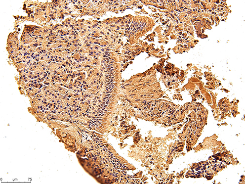 Figure 9 The immunohistochemical staining results of the day 14 group were observed under 200X microscope.