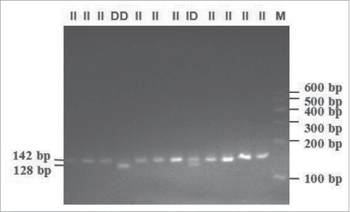 FIGURE 2. Electrophoresis pattern of 14-bp indel in 3′ UTR within bovine PRNP gene (genotyped by 3.5% agarose gel) (II demontrated 142-bp length band; ID demonstrated 142-bp and 128-bp length bands; DD demonstrated 128-bp length band).