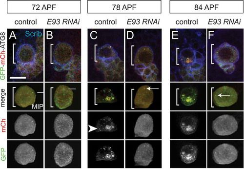 Figure 1. Eip93F is required for autophagosome and autolyosome formation in MB neuroblasts during late stages of pupal development. (a–f) Top, colored overlay of MB neuroblasts (white brackets) at the indicated times. (a,c,e) Wild-type control genotype: worGAL4,UAS-GFP-mCh-Atg8. (b,d,f) Eip93F knockdown (E93 RNAi) genotype: worGAL4,UAS-GFP-mCh-Atg8,UAS-E93 RNAi. Below, colored overlay of cropped, maximum intensity projection of MB neuroblast shown above, with single channel grayscale images below. White arrows indicate autophagomes (mCh and GFP double positive) and arrowheads indicate autolysosomes (mCh only). (a–f) Scale bar: 10 μm. scrib (scribble, blue) is a membrane marker to denote the MB neuroblast. APF, after pupal formation. Reprinted from Current Biology, 29(5), Pahl, M.C., Doyle, S.E., and Siegrist, S.E., E93 Integrates neuroblast intrinsic state with developmental time to terminate MB neurogenesis via autophagy, Figure 4A-F, 2019, with permission from Elsevier.