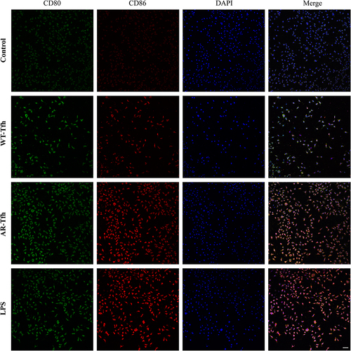 Figure 2 Expression of CD80 and CD86 of DCs under four different conditions. Immunofluorescence staining was performed to determine the expression level of CD80 and CD86 on DC cell surface. Scale bar at the bottom right stands for 50 μm. Data shown are representative of 3 independent experiments. Green represents CD80 staining, red CD86 staining, and blue DAPI staining for cell nuclei.