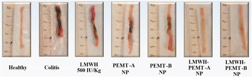 Figure 5. Colon tissues of mice treated with LMWH and LMWH-NP formulations. The dose of both the drug and drug-loaded NP was equal to 500 IU/kg. Neither clear necrosis in the crypt nor an obvious damage was detected in the colonic mucosa of LMWH-NP groups, while clear necrosis was observed in the disrupted colon architecture in the other groups.