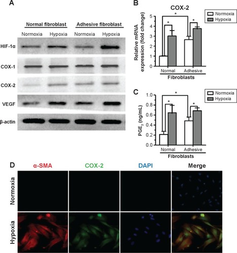 Figure 2 Hypoxia promotes cyclooxygenase (COX)-2 expression and function in fibroblasts from the normal peritoneum.