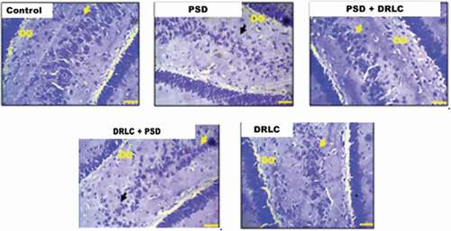 Figure 6. Representative photomicrograph showing the expression of nissl substance in the hippocampus of the wistar rats across the experimental groups stained with cresyl fast violet stain (scale bars: 50 µm) .