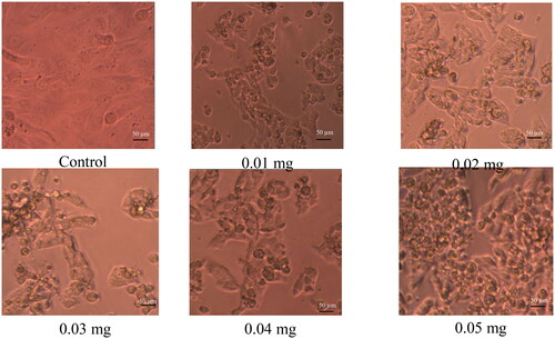 Figure 5. SK-BR3 cells kept for incubation at different concentrations of NCE (hexane to ethanol ratio of 6:4) for about 24 h and observed under an inverted light microscope. Note. Images were captured with a 40× objective on an inverted light microscope. Scale bars correspond to 50 μm.