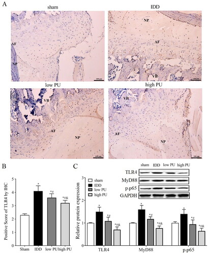 Figure 3. Effects of PU on TLR4/NF-κB signalling pathway in IDD rats. (A, B) IHC analysis of TLR4 expression in IVD tissue (scale = 100 μm). VB: vertebral body, NP: nucleus pulposus, AF: annulus fibrosus; C: The protein expression levels of TLR4, MyD88, and p-p65 were analysed by western blot. Data are represented by mean ± SD, n = 9. *p < 0.05, vs. Sham group, #p < 0.05, vs. IDD group, &p < 0.05, vs. low PU group.