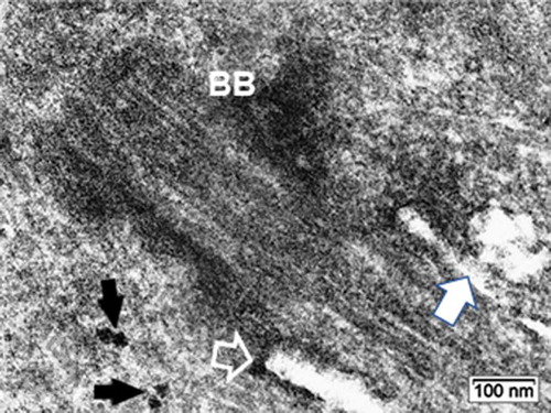 Figure 10. ODS12h oligodendrocyte primary cilium: Basal body (BB) zone and cilium pocket basal edge (open arrow); it is shown with an irregularly shaped fusing vesicle issued from fused aggregated small ones (white arrow), surrounding its axoneme. Black arrows indicate two evident polyribosomes