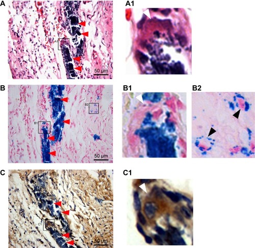 Figure 7 Representative histology of the injection sites 6 months after cell injection.Notes: (A) HE staining. A1 is the inset of A and shows the giant multinucleated cells. (B) Prussian blue staining. B1 inset shows the giant multinucleated cells at the corresponding site to A1 inset. (B2) inset shows the iron-containing, small-sized, non-macrophage interstitial cells. (C) CD68 immunohistochemical staining. C1 inset showing the CD68-positive giant multinucleated cells at the corresponding site to A1 inset and B1 inset. Massive Prussian blue-positive iron deposits were detected at the injection sites. Iron particles were predominantly distributed in the extracellular space (red arrows in A–C), whereas a minority of iron particles were distributed within CD68-positive macrophages (white arrows in A1, BI and C1) and other CD68-negative cells (black arrows in B2).Abbreviation: HE, hematoxylin eosin.