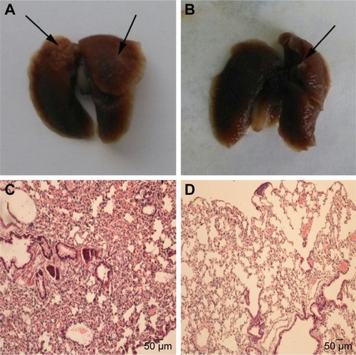 Figure 6 Baicalein suppresses lung metastasis of breast cancer in vivo.
