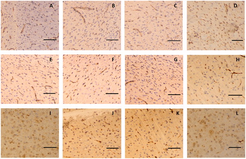 Figure 6. Representative immunohistochemical images of claudin-5 in brain tissue of glioma rat after borneol exposure at different time points: (A) 5 min in control group, (B) 30 min in control group, (C) 45 min in control group, (D) 2 h in control group, (E) 5 min in low-borneol group, (F) 30 min in low-borneol group, (G) 45 min in low-borneol group, (H) 2 h in low-borneol group, (I) 5 min in high-borneol group, (J) 30 min in high-borneol group, (K) 45 min in high-borneol group and (L) 2 h in high-borneol group. Scale bars, 100 μm.