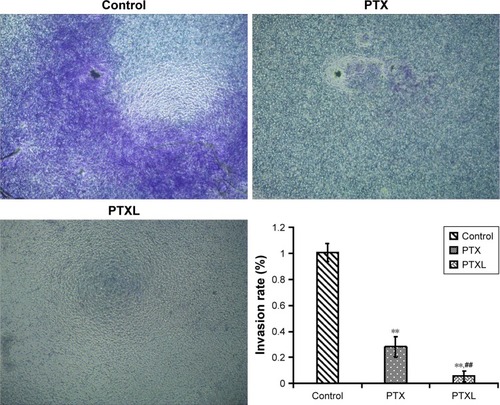 Figure 7 Crystal violet staining of the invasion cells after incubation for 24 hours.Notes: **P<0.01 vs control. ##P<0.01 vs PTX (magnification: ×40).Abbreviations: PTX, paclitaxel; PTXL, paclitaxel–cholesterol-loaded liposomes.