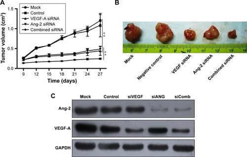 Figure 3 Effects of siRNA therapy on tumor in vivo.Notes: (A) Tumor growth curve. (B) Tumor volume. (C) Western blotting of VEGF-A and Ang-2 protein expression after siRNA therapy. (D) Analysis of VEGF-A expression in tumor tissues. (E) Analysis of Ang-2 expression in tumor tissues. **P<0.01. (F) Photomicrograph of immunohistochemical staining of vWF (200×). (G) MVD. The arrows are directed to the vessels for MVD. **P<0.01.Abbreviations: GAPDH, glyceraldehyde 3-phosphate dehydrogenase; MVD, microvessel density; siRNA, small interfering RNA; VEGF, vascular endothelial growth factor; vWF, Von Willebrand factor.