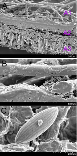 Figure 4. Scanning electron micrograph of Microstoma ningshanica. A: anatomic structure of portion of apothecium (A1, haris; A2, excipulum; A3, hymenium); B: hairs; C: ascospore.