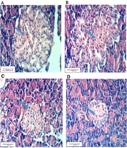 Figure 3. Pancreatic section of G1 showing normal tissues, B: Pancreatic section of G2 with vacuolation of Langerhan’s islets, C: Pancreatic section of G3 showing Langerhan’s islets with slight hyperplasia, D: Pancreatic section of G4 with normal tissue (H & E ×400).