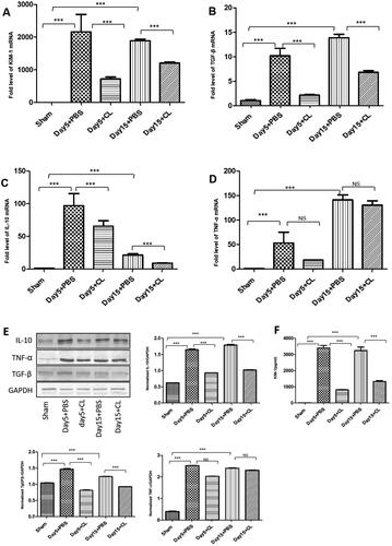 Figure 6. Clodronate liposomes decreased inflammatory cytokines secretion following I/R injury. KIM-1 (A), TGF-β (B), IL-10 (C) and TNF-α (D) mRNA expression were detected by RT–PCR in each group. IL-10 (E), TNF-α (E), and TGF-β (E)expression was detected by Western blotting in each group, KIM-1 (F) expression was detected by ELISA in each group. n = 10 (***p < 0.001, **p < 0.005, *p < 0.05).