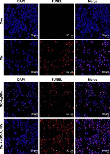 Figure 12 Combination of Cis and rGO-AgNPs enhanced apoptosis.Notes: Cells were treated with Cis (5 μM), rGO-AgNPs (1 μg/mL), or both Cis (5 μM) and rGO-AgNPs (1 μg/mL) for 24 hours. Apoptosis was assessed with a TUNEL assay; the nuclei were counterstained with DAPI. Representative images show apoptotic (fragmented) DNA (red staining) and corresponding cell nuclei (blue staining).Abbreviations: Cis, cisplatin; rGO, reduced graphene oxide; NPs, nanoparticles; Con, control.