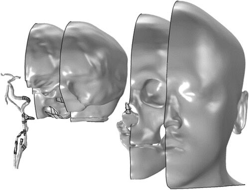 Figure 1. Head model geometry containing (from left to right): carotid arteries, brain, cerebrospinal fluid (CSF), skull, skin and soft tissues.