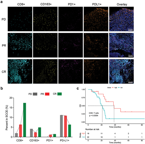 Figure 3. Efficacy of neoadjuvant immuno-chemotherapy associated with tumor infiltrating CD8+ T cells and PD-L1 expression. (a and b) Multiplex immunohistochemistry (mIHC) imaging (a) and quantitative assay (b) of the SCCE samples staining with CD8, CD163, PD1 and PD-L1 antibodies. Scale bar: 100 μm. (c) Kaplan-Meier survival analysis of the SCCE patients with low/high expression of CD8+ T cell using the previous SCCE cohort from Renda Li’s team. Expression of CD8+ T cell was calculated according to ssGSEA analysis and the SCCE cohort was divided into low/high expression groups using an optimal cutoff value of expression of CD8+ T cell.