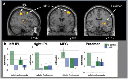 Figure 4. A shows significant activation for the interaction between conflict and age group. Adults showed increased activation during social agreement in the bilateral parietal cortex (IPL), right middle frontal gyrus (MFG) and putamen, compared to adolescent participants (see Table 4). Results were cluster level corrected (p < 0.05, voxel-level uncorrected p < 0.001, cluster level corrected at pFWE < 0.05). B shows estimates for the four observed clusters (bilateral IPL, MFG and putamen). The bar charts represent mean parameter estimates with standard error bars in age group x conflict cluster.