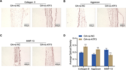 Figure 4 Effects of ATF3 knockdown on extracellular matrix proteins in the articular cartilage of rats with OA. (A–D), Expression of collagen II (A), aggrecan (B) and MMP-13 (C) in rat knee joints from rats (n=4) detected by immunohistochemistry and quantified by ImageJ software (D). Scale bar = 400 μm. Error bars are mean ± s.d. **P < 0.01 vs OA+si-NC group.