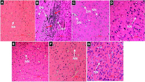 Figure 6. Histological examination of rat brain cortex. H&E 400 × (A) DMSO-treated rat brain cortex showing cytoarchitecture of normal neurons (NN). (B) L-Methionine-treated rat cortical region showing a larger area of necrotic foci (Red Arrows) in brain parenchyma along with lymphocyte infiltration (L-INF) and degenerating neurons (DN). (C) HSP-25mg/kg-treated showing rat cortical region with no signs of necrotic foci and L-INF in brain parenchyma. However, DN similar to L-methionine-treated group were noticed along with normal neurons. (D) HSP -50 mg/kg-treated rat cortex region showing many neurons with normal structure and the cytoarchitecture of neurons was similar to the control group. (E) HSP-100mg/kg)-treated rat cortex region showing cytoarchitecture of normal neurons (NN) similar to the control group. (F)HSP-Per se-treated rat cortex region showing cytoarchitecture of normal neurons (NN) similar to the control group. (G)Donepezil-treated rat cortex region showing cytoarchitecture of normal neurons (NN) similar to the control group.