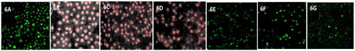 Figure 6. Cytotoxicity against CNE-2 cells of 6A. PBS (control); 6B. Free cisplatin; 6C.Free docetaxel; 6D. ZnO nanoparticles; 6E. DOC-FOL-PEG-ZnO; 6F. CIS-FOL-PEG-ZnO; 6G. DUAL-FOL-PEG-ZnO.