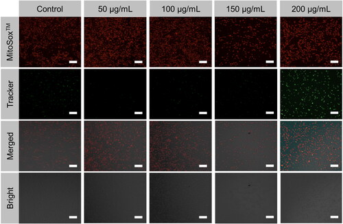 Figure 5. Mitochondrial oxidative stress triggered PEG@mTa2O5 by HCMECs. The images of HCMECs are stained with MitoTracker Green and MitoSOX™ fluorescence. Scale bar 100 µm.