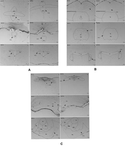 Figure 4 Analysis of c-Fos expression between SGLT-2i (A, B, C) and control group (D, E, F) in MnPO, PVA, and PVN (A); Superior colliculus, PAG, and LC (B); NTS, CA3, and amygdalar nuclei (C); Scale bar: 100μm.Abbreviations: MnPO, median preoptic nucleus; ac, anterior commissure; PVA, paraventricular thalamic nucleus; D3V, dorsal 3rd ventricle; PVN, paraventricular hypothalamic nucleus; 3V, 3rd ventricle; Aq, aqueduct; PAG, periaqueductal gray; LC, locus coeruleus; 4V, 4th ventricle; NTS, nucleus of solitary tract; AP, area postrema; CC, central canal; CA3, the field CA3 of hippocampus; Me, medial amygdala nucleus; Ce, central amygdala nucleus; BMA, basomedial amygdala nucleus; BLA, basolateral amygdala nucleus; Pirl, piriform cortex.