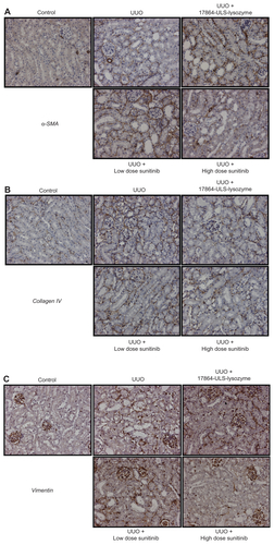 Figure S2 Representative microscopic images of paraffin-embedded kidney sections immunostained for α-SMA (A), collagen IV (B), and vimentin (C). In the pathogenesis of renal fibrosis α-SMA is involved in EMT of normal epithelial cells into myofibroblasts, collagen IV in ECM production and vimentin in both processes.Note: The magnification for all images was 20×.Abbreviations: SMA, smooth muscle actin; EMT, epithelial-to-mesenchymal transition; ECM, extracellular matrix; UUO, unilateral ureteral obstruction.