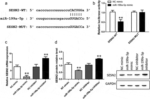 Figure 6. SESN2 is the target gene of CDKN2B-AS1 and its site of interaction. a: SESN2 and miR-199a-5p binding site sequences, including SESN2-WT and MUT. b: The targeting relationship between SESN2 and miR-199a-5p was detected by a dual luciferase reporter assay. **p < 0.01 compared with the cotransfection of SESN2-WT and the NC mimic. c: RT–qPCR was used to determine the mRNA expression level of SESN2. d: The expression of SESN2 was determined by Western blotting. **p < 0.01 compare with the NC group. Data are presented as means ± SD (n = 3).