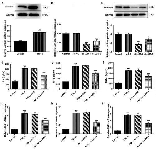 Figure 1. LUM expression was notably decreased in TNF-α-induced hNPCs and LUM deletion reduced TNF-α-induced inflammatory response in hNPCs. (a) Detection of LUM protein expression by means of western blot in the control group and in hNPCs stimulated with TNF-α. N = 3. ***P < 0.001 vs. control. (b–c) Detection of the interference efficacy of si-LUM1/2 by means of RT-qPCR and western blot analysis in hNPCs. N = 3. **P < 0.01, ***P < 0.001 vs. si-NC. (d–f) The concentrations of pro-inflammatory cytokine levels in hNPCs stimulated with TNF-α or transfected with si-NC/si-LUM-1was examined with ELISA kits. (g–i) RT-qPCR was used to evaluate the mRNA expression of pro-inflammatory cytokine in hNPCs stimulated with TNF-α or transfected with si-NC/si-LUM-1. N = 3. ***P < 0.001 vs. control; ###P < 0.001 vs. TNF-α+ si-NC