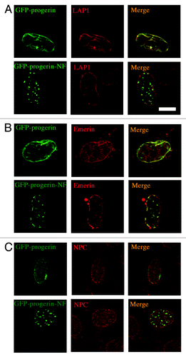 Figure 6. Effects of expressing non-farnesylated progerin on the distribution of two integral proteins of the inner nuclear membrane and non-membrane nuclear pore complex (NPC) proteins. (A) Confocal fluorescence micrographs showing localizations of GFP-progerin and GFP-progerin-NF (green signals) and immunofluorescence labeling with anti-LAP1 antibodies (red signal). (B) Confocal fluorescence micrographs showing localizations of GFP-progerin and GFP-progerin-NF (green signals) and immunofluorescence labeling with anti-emerin antibodies (red signals). (C) Confocal fluorescence micrographs showing localizations of GFP-progerin and GFP-progerin-NF (green signals) and immunofluorescence labeling with antibodies that recognize NPC proteins (red signals). Merged images of the same cells are shown at the right of each panel with signal overlap appearing yellow (merge). Bar: 5 µm.