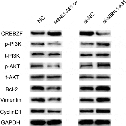Figure 9. Western blotting results showed that MBNL1-AS1 affected PI3K/Akt pathway-related proteins through CREBZF. The phosphorylation of PI3K and Akt was changed, whereas the total PI3K and Akt remained the same, and further affected apoptosis pathway-related protein (Bcl-2), proliferation pathway-related protein (CyclinD1), and EMT pathway-related protein (Vimentin). NC, negative control, with MCF-7 cells transfected with blank plasmid; MBNL1-AS1 ov, MBNL1-AS1 overexpression, with MCF-7 cells transfected with MBNL1-AS1 overexpression plasmid; Si-NC, negative control of siRNA, with BT474 cells transfected with negative control of siRNA; si-MBNL1-AS1, siRNA of MBNL1-AS1, with BT474 cells transfected with siRNA of MBNL1-AS1.