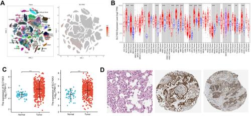 Figure 1 High SLC16A3 expression in lung cancers. (A) Single-cell RNA sequencing of SLC16A3 in normal tissues from Human Cell Landscape. (B) The expression of SLC16A3 in pan-cancers. (C) Significant increase of SLC16A3 was found in both LUAD (left) and LUSC (right). (D) Immunohistochemistry images (from Human Protein Atlas) of SLC16A3 expression in normal lung tissue (left), LUAD (middle) and LUSC (right). ***P < 0.000.