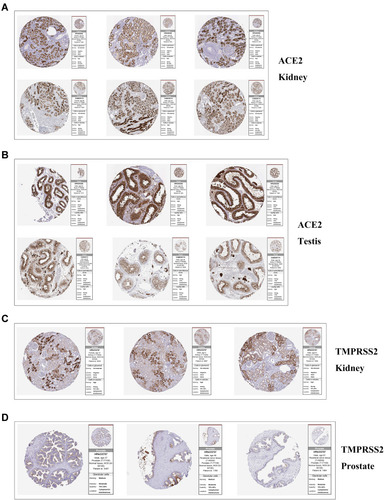 Figure 2 The panel of immunohistochemical image of ACE2 and TMPRSS2 in target organs.