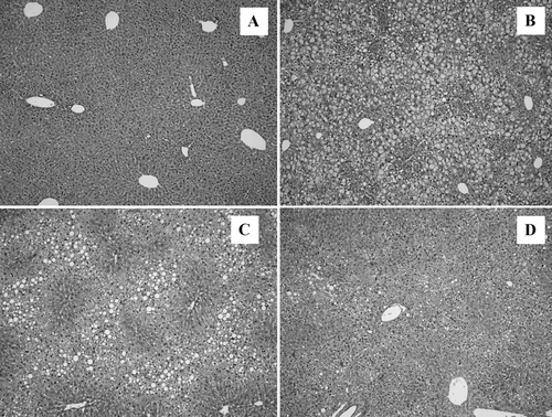 Figure 1. Representative micrographs of liver sections after 6 weeks of feeding either control high‐fat liquid diet to C3+/+ (A) and C3−/− (B) mice or ethanol‐high‐fat liquid diet to C3+/+ (C) and C3−/− (D) mice. Formalin‐fixed sections stained with hematoxylin/eosin were used. Note the marked mixed micro‐ and macrovesicular steatosis after control diet in C3−/− mice (B) as compared to C3+/+ mice (A). While ethanol feeding caused significant steatosis in C3+/+ mice (C) only minor steatosis was seen in C3−/− mice (D).