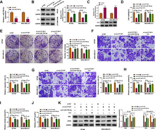 Figure 6 The circYY1/miR-769-3p/YY1 axis regulated the malignancy and glycolysis of BC cells. (A) QRT-PCR analysis of miR-769-3p expression in BT549 and MDA-MB-231 cells transfected with anti-miR-769-3p or anti-NC. (B) Western blotting analysis of YY1 protein level in BT549 and MDA-MB-231 cells transfected with si-NC, si-circYY1#1, or si-circYY1#1+anti-miR-769-3p. (C) The protein level of YY1 in BT549 and MDA-MB-231 cells transfected with vector or YY1 was analyzed with Western blotting. (D–K) BT549 and MDA-MB-231 cells were transfected with si-NC, si-circYY1#1, si-circYY1#1+anti-miR-769-3p, or si-circYY1#1+YY1. (D–G) The viability, colony formation, migration, and invasion of BT549 and MDA-MB-231 cells were determined by MTT assay (D), colony formation assay (E), or transwell assay (F and G). (H–J) The levels of glucose uptake, lactate production, and ATP release in BT549 and MDA-MB-231 cells were analyzed with a matching kit. (K) Assessment of HK2 and LDHA protein levels in BT549 and MDA-MB-231 cells by Western blotting. **P < 0.01 and ***P < 0.001.