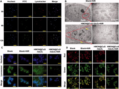 Figure 5. Antitumour mechanism induced by HMON@CuS/Gd2O3 plus NIR based on lysosomal disruption. (A) Confocal imaging of SKOV-3 cells incubated with FITC-labelled HMON@CuS/Gd2O3. At the designated incubation time, the cells were costained with LysoTracker Deep Red and Hoechst 33342 for imaging. Scale bar, 100 μm. (B) TEM images of SKOV-3 cells treated with HMON@CuS/Gd2O3 plus NIR irradiation. (C) Fluorescence images of SKOV-3 cells stained with LysoSensor Green DND-189 (scale bar, 30 μm). (D) Confocal imaging of SKOV-3 cells preincubated with HMON@CuS/Gd2O3 plus NIR irradiation followed by staining with acridine orange (AO). Scale bar, 50 μm.