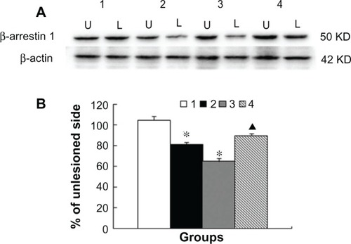 Figure 4 Changes in â-arrestin-1 protein expression in rat striatum. Rats were subject to sham surgery (group 1), 6-OHDA lesion (group 2), 6-OHDA lesion followed by 23 daily treatments with levodopa (group 3), or coadministration of MK-801 and levodopa on the last day (group 4). Protein levels of â-arrestin-1 in the striatum on the lesioned (L) and nonlesioned (U) sides were assayed by Western blotting. Representative immunoblots (A) are shown above the quantification of data (B).