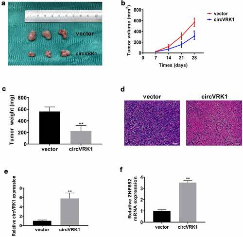 Figure 4. CircVRK1 suppresses osteosarcoma growth in vivo