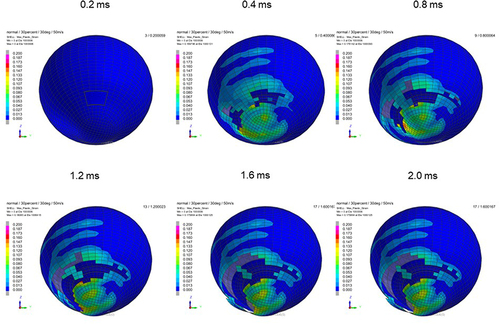 Figure 10 Sequential strain strength response of ocular surface of model eye upon airbag impact in 30°-gaze down position at 50 m/s with adhesion strength of scleral flap of 30%, shown at 0.4-ms intervals after 0.2 ms. Strain strength change is displayed in color as presented in the color bar scale (Figure 2).